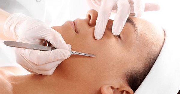 Le dermaplaning, test et&nbsp;avis